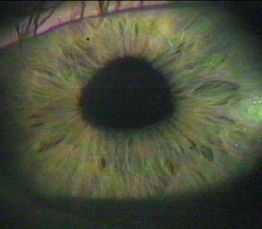 Adies pupil color